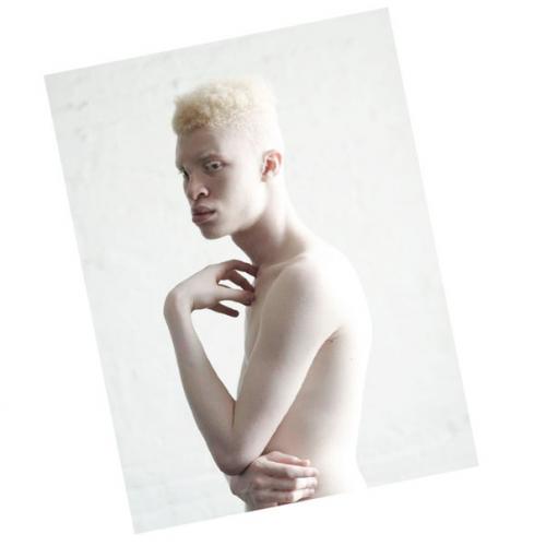 Каково быть моделью - альбиносом? 
