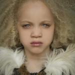 Юная афроамериканка - альбинос с ангельским лицом покоряет мир моды.

